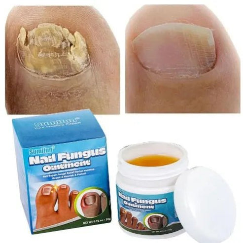 Sumifun - Nail Fungus Ointment (Original)