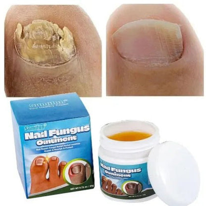 Sumifun - Nail Fungus Ointment (Original)